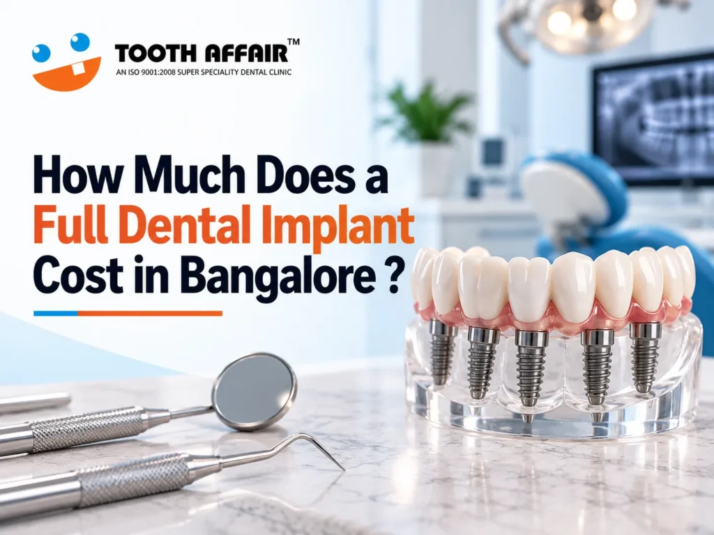 How Much Does a Full Dental Implant Cost in Bangalore Complete 2026 Guide