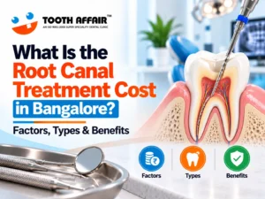 Root Canal Treatment Cost in Bangalore: Prices, Factors, Types & Tips