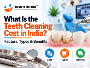 Teeth Cleaning Cost in India: Benefits, Procedure and Tips